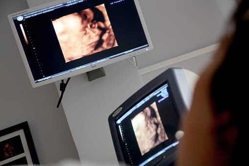 ultra sound images